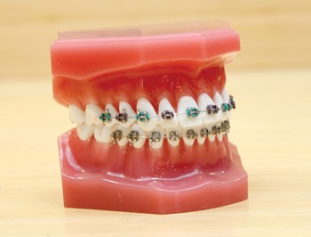 Orthodontics5